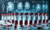 Kidney Blood Test in Blackburn: A Comprehensive Overview