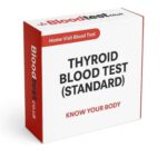 Thyroid Blood Test: Your Guide to NHS Testing in Gateshead